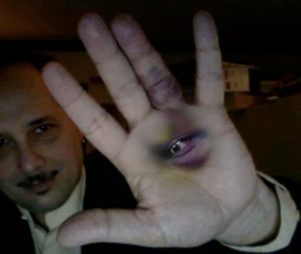tpkunesh's eye in his hand, by Barry Radun 2010 Toronto